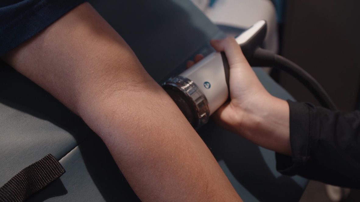SoftWave shockwave therapy on the forearm