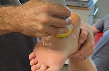 Shockwave Applicator Being Used On Patient's Heel